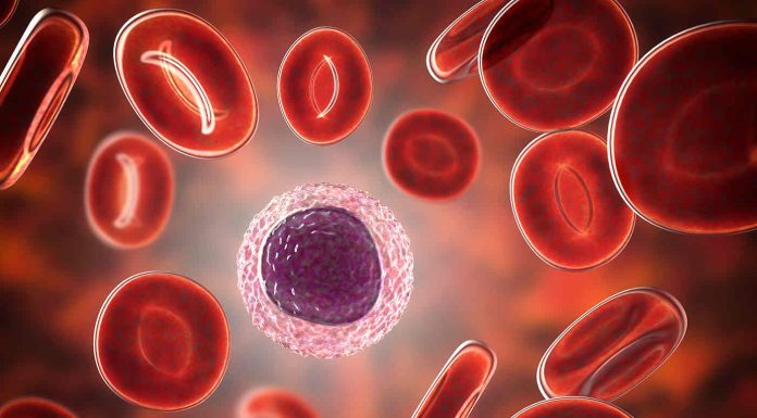 Limfocite scăzute: Cauze, simptome și tratament